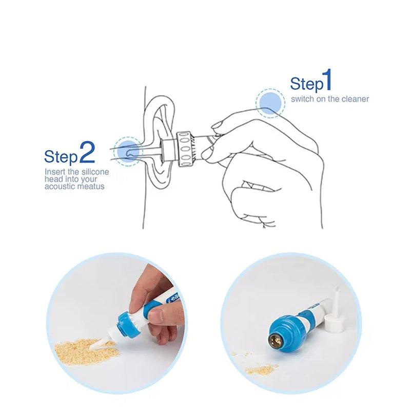Electric Cordless Ear Cleaner with Painless Wax Removal Function Alteris